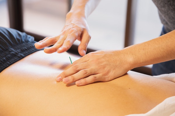 How To Become An Acupuncturist in Ontario